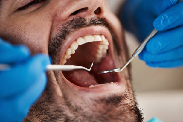 Best Urgent Care for Lost Fillings or Crowns in Oskaloosa, IA
